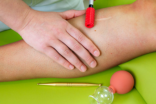 Narbenbehandlung